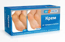 КРЕМ ОТ ТРЕЩИН В СТУПНЯХ СЕРИИ ДО И ПОСЛЕ / KREM OT TRESHCHIN V STUPNYAH SERII DO I POSLE