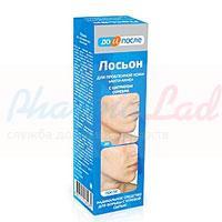 Лосьон для проблемной кожи АНТИ-АКНЕ серии ДО И ПОСЛЕ / LOTION